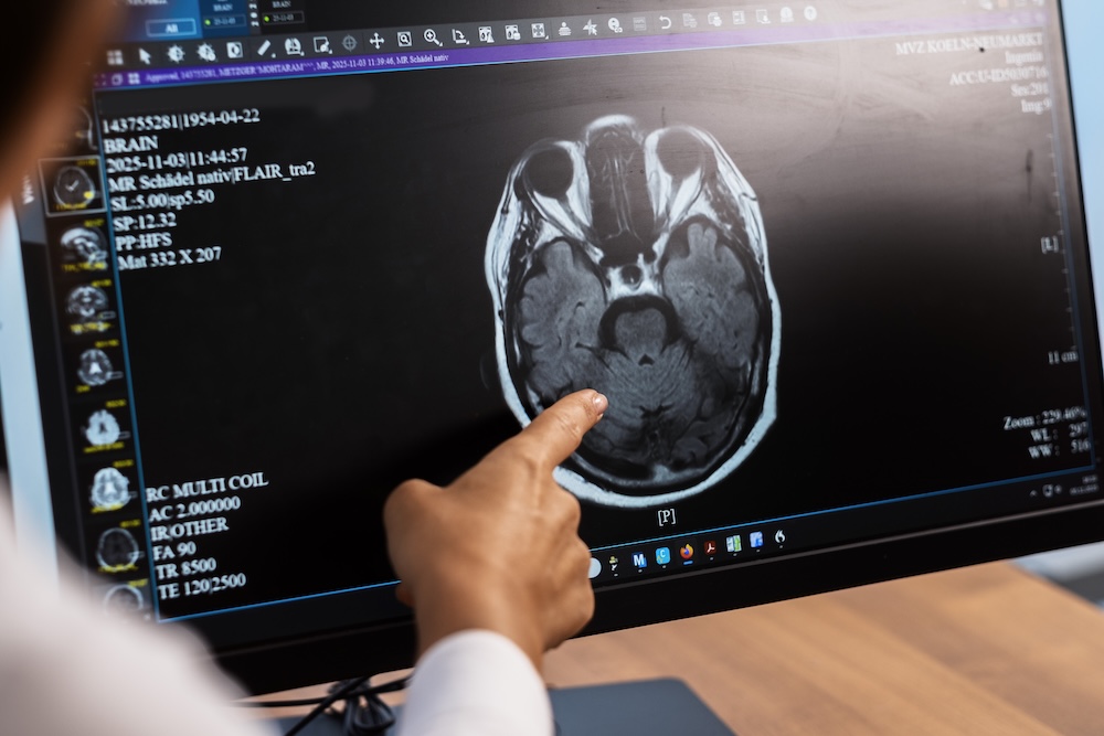 neurologe-koeln-innenstadt-demenz