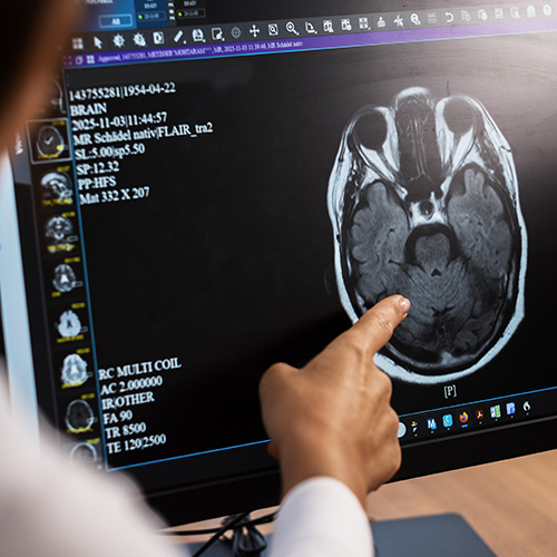 neurologe-koeln-innenstadt-demenz-gallerie